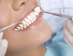 Dental cleaning